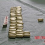 Autopsy of a drug mule