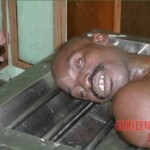 Autopsy of a drug mule