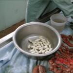 Autopsy of a drug mule