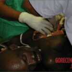 Autopsy of a drug mule