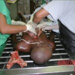 Autopsy of a drug mule