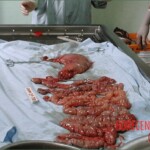 Autopsy of a drug mule