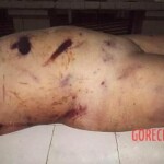 Beaten, raped and murdered woman