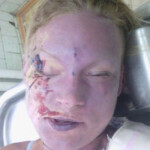 Female suicide jumper