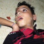Chemical attack in Syria