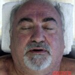 Corpse examination of obese male