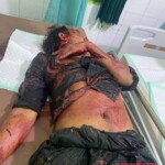 Machete fight victim