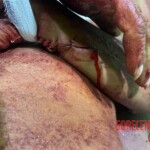 Machete fight victim