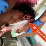 Machete fight victim