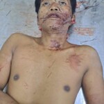 Machete fight victim