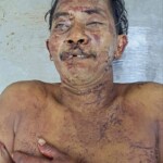 Machete fight victim