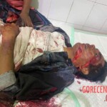 Machete fight victim