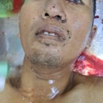 Machete fight victim