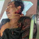 Machete fight victim