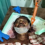 Machete fight victim