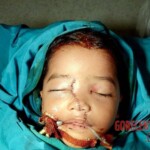 Surgery of little boy