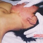 Hanged woman in morgue