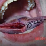 Half-stitched tongue split