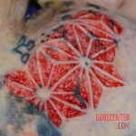 Facial scarification
