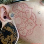 Facial scarification