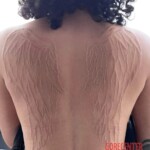 Angel wings scarification