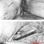 Old photo of raped an murdered woman