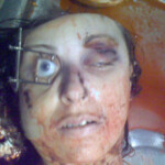 Necrophiliac sexually abuses dead girl in morgue