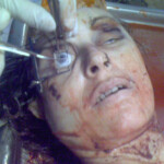 Necrophiliac sexually abuses dead girl in morgue