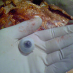 Necrophiliac sexually abuses dead girl in morgue