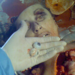 Necrophiliac sexually abuses dead girl in morgue