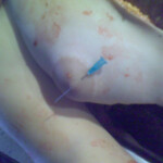 Necrophiliac sexually abuses dead girl in morgue