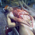 Necrophiliac sexually abuses dead girl in morgue