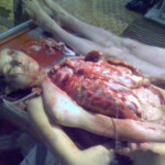 Necrophiliac sexually abuses dead girl in morgue