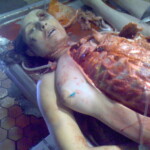 Necrophiliac sexually abuses dead girl in morgue