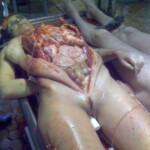 Necrophiliac sexually abuses dead girl in morgue