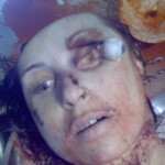 Necrophiliac sexually abuses dead girl in morgue