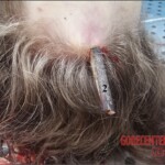 Girl impaled on railing