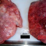 Lungs Autopsy of young Chinese woman