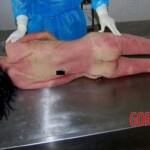 Autopsy of young Chinese woman