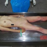Autopsy of young Chinese woman