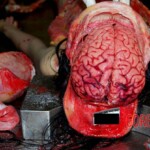 Brain Autopsy of young Chinese woman