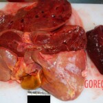 Liver and spleen Autopsy of young Chinese woman