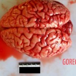 Brain top Autopsy of young Chinese woman