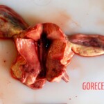 Uterus Autopsy of young Chinese woman