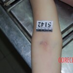 Autopsy of Chinese woman