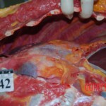 Autopsy of Chinese woman