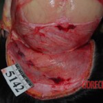 Autopsy of Chinese woman