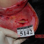 Autopsy of Chinese woman