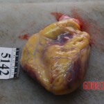Autopsy of Chinese woman