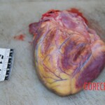 Autopsy of Chinese woman